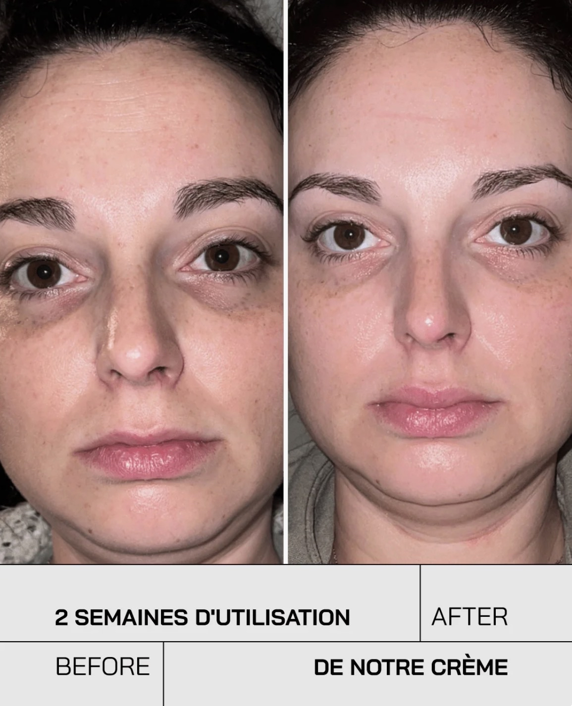 Crème hydratante visage