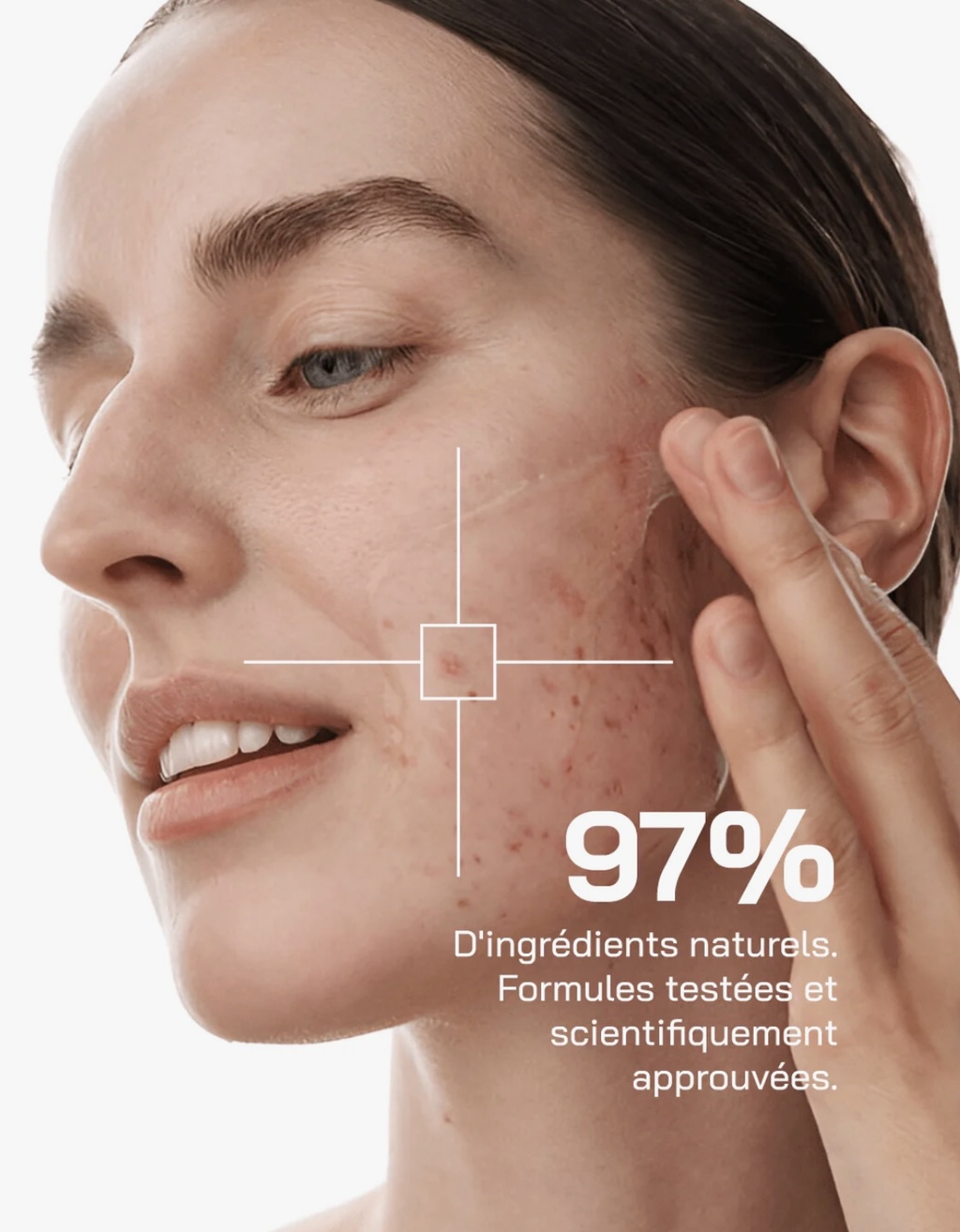 Sérum Niacinamide 10% + Zinc 1%