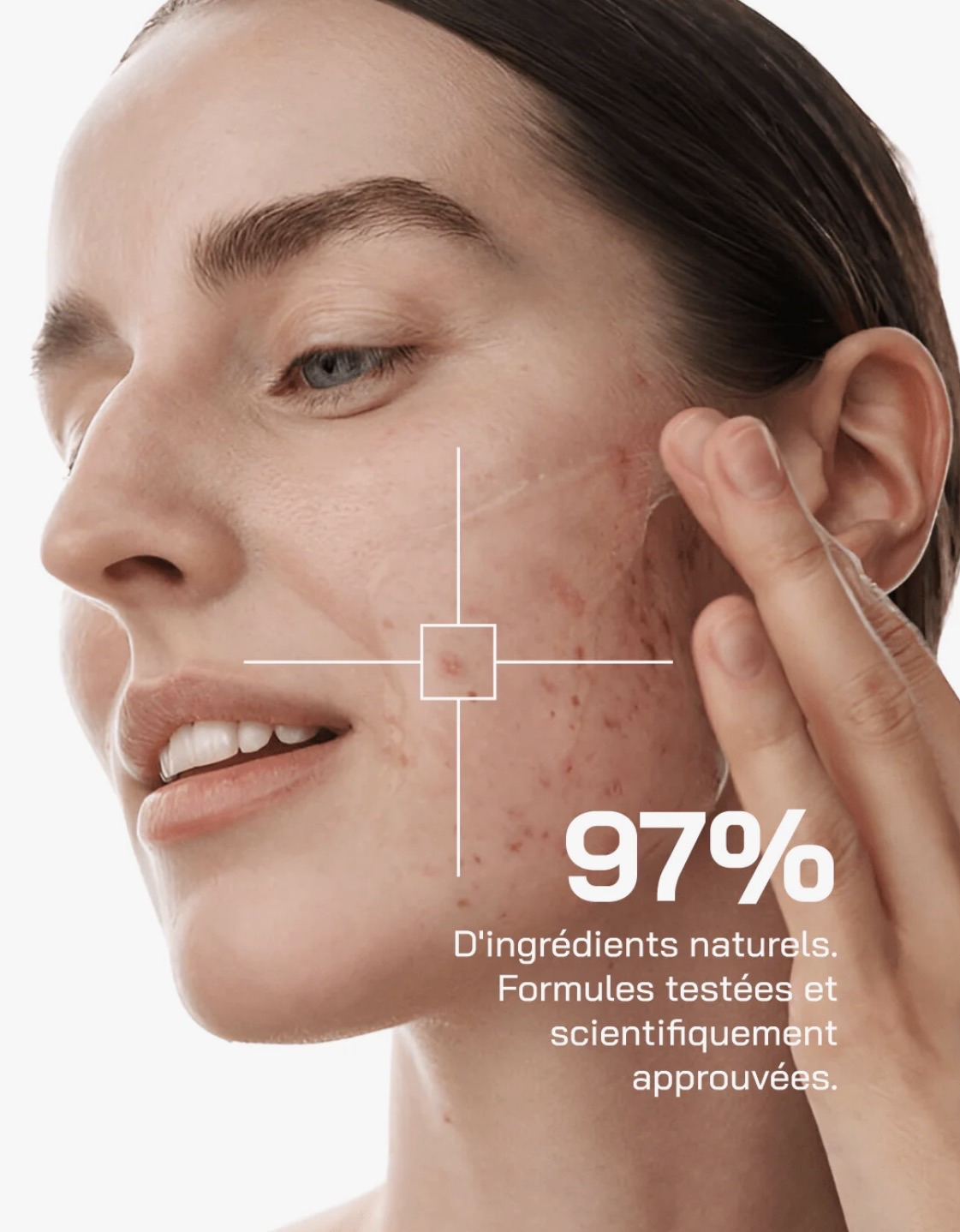 Sérum Niacinamide 10% + Zinc 1%