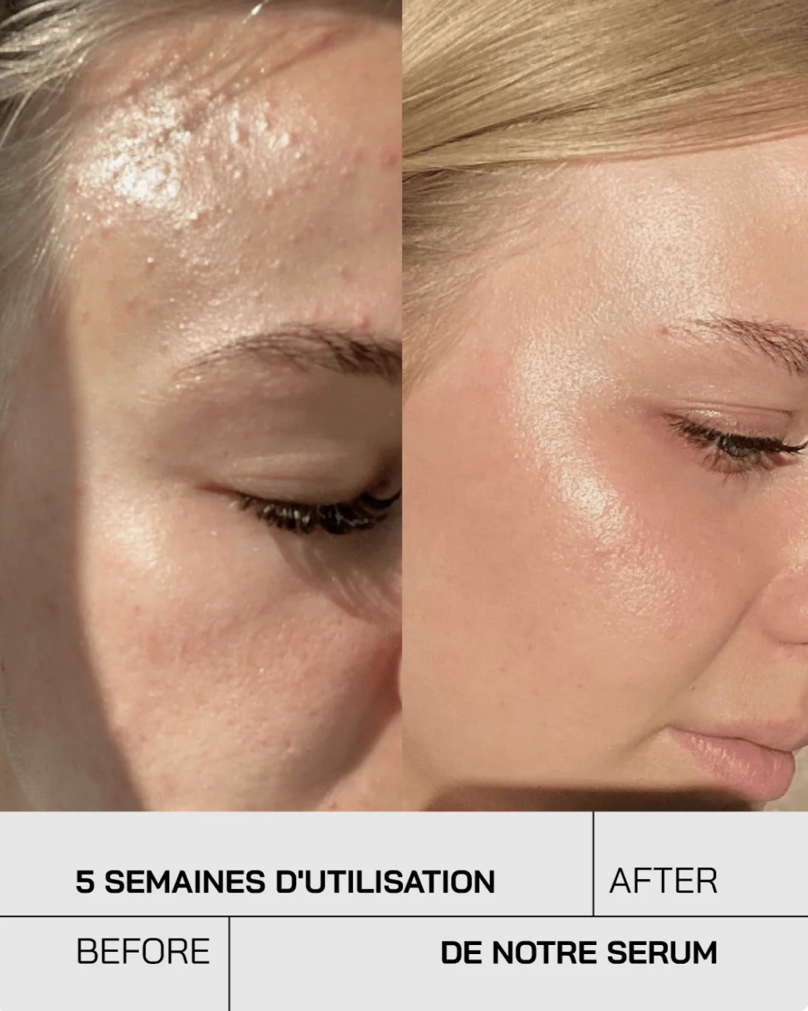 Sérum Niacinamide 10% + Zinc 1%